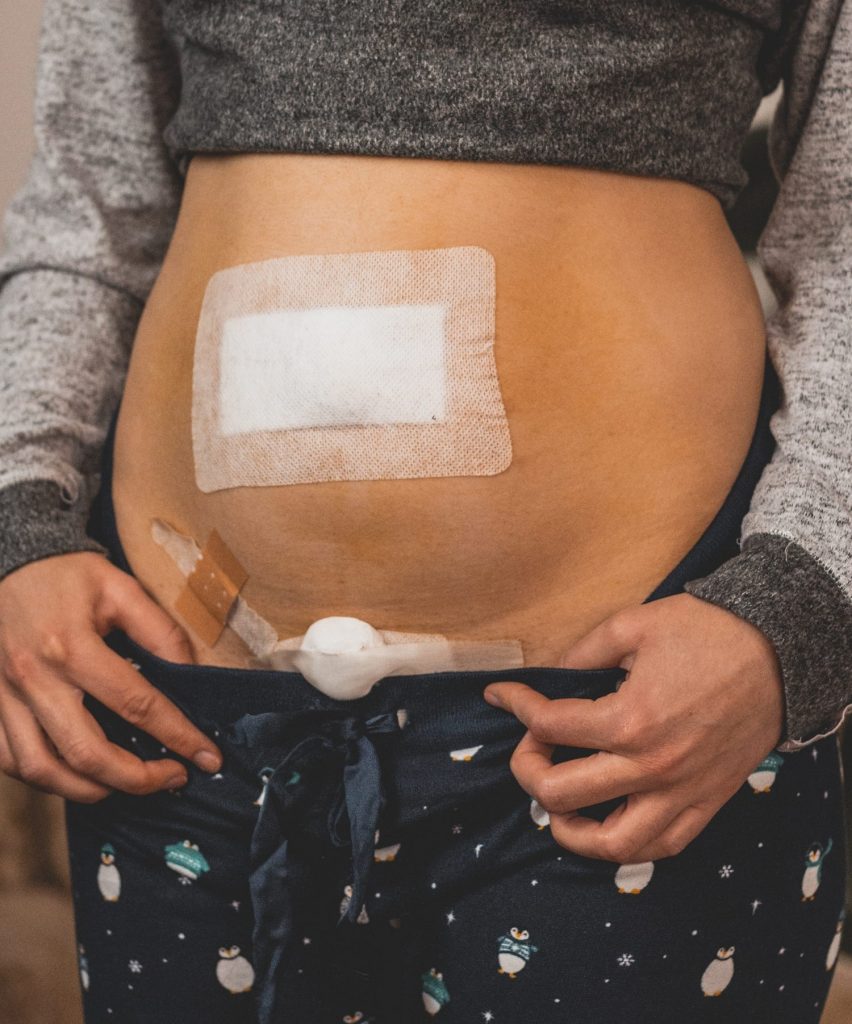 Lea fotografiert sich im Alltag, begleitet von persönlicher Erzählung zu Endometriose