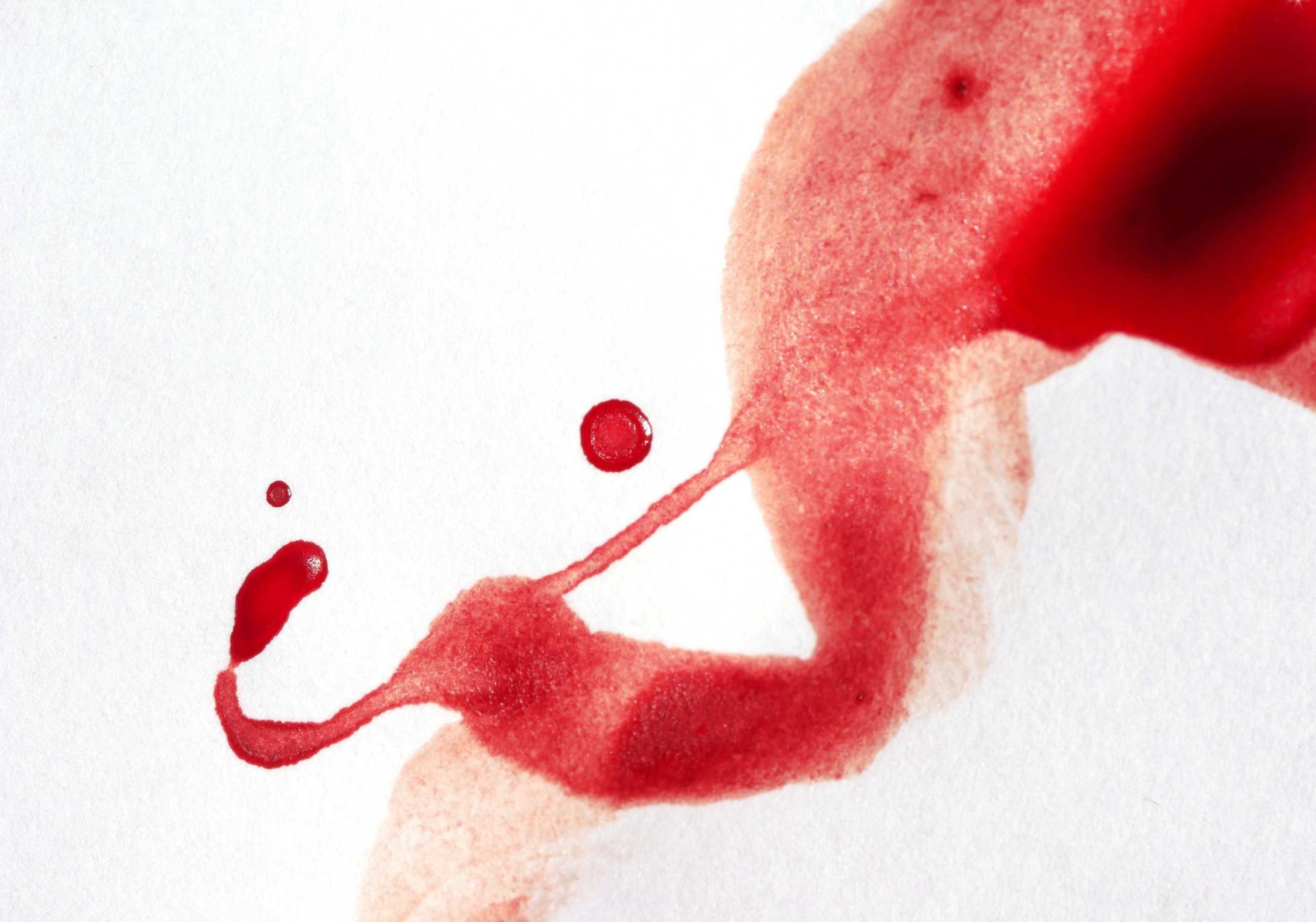 Menstrual blood collected in a small cup for artwork